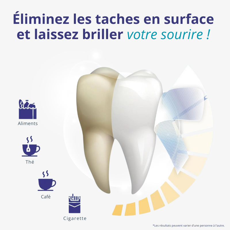 BANDES BLANCHISSANTES
